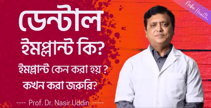 implement kno kora hoy